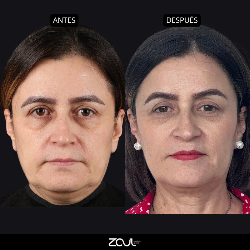 RETRACTION - Dra Carolina Hoyos